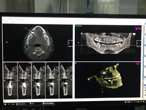 1590388460866086808.jpg 4c3d39f8d72c2e436881c3778495b17.jpg