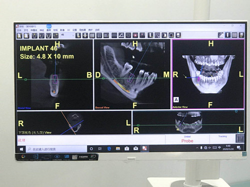 1590388447012011650.jpg 0242e3946101d7e6ed1f909acf9cc8e.jpg